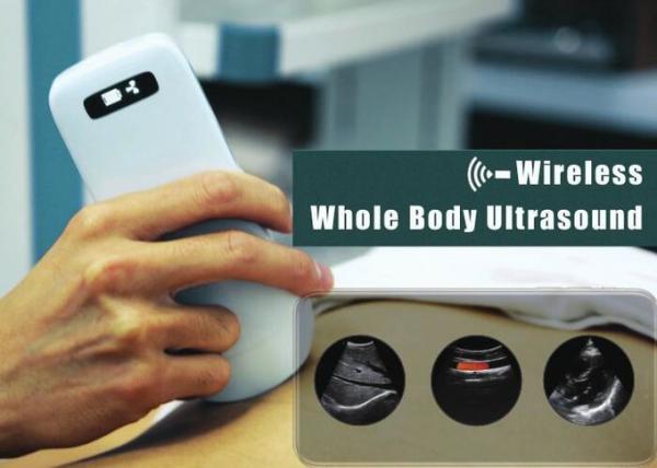 5G Wifi Handheld Ultrasound Scanner Pocket Ultrasound Built - in 4200mAh Lithium Battery Wireless Charger Supported 1