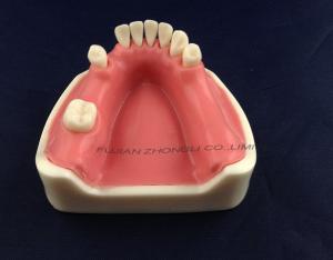 Wholesale medical science dental implant model with soft gingiva from china suppliers