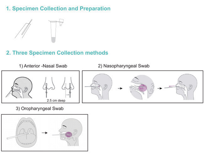 Accuracy 99.68% Antigen Swab Test Kit SARS-CoV-2 25 Tests/Kit CE