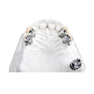 Wholesale Easy Clean OEM Precision Attachment Partial Denture Stain Resistant from china suppliers