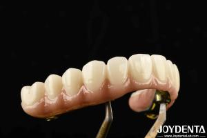 Wholesale Durable Ti-Bar Zirconia Hybrid Bridge Made Of Titanium And Zirconia Materials For Heavy Us from china suppliers