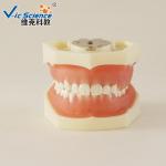 Peridontal Disease Teeth Study Model Human Dental Model Gingival Diseases