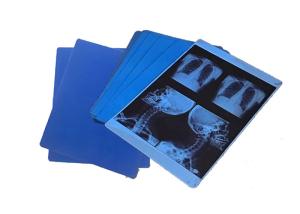 Wholesale Digital X Ray Medical Imaging Film Blue Sensitive X Ray Film For CT MRI from china suppliers