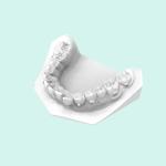 High Temperature Resistant Orthodontic Model Dental Resin 3d Printing