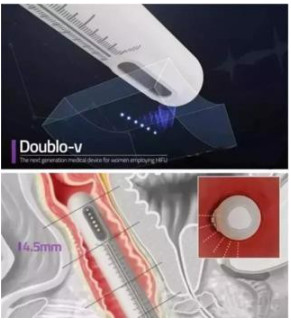 GOMECY 12 Lines 8 Cartridges 4D Hifu Face Lifting Machine Skin Tightening