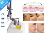 Clinic vaginal Laser Machines fractional CO2 ance scar removal laser Without