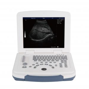 China BW Laptop Ultrasound Machine Full Digital Ultrasound Scanner GH580 on sale