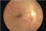 Store Images And Videos Portable Fundus Camera