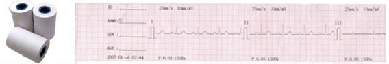 Digital Single Ecg Machine 1 Channel Heart Monitoring Device
