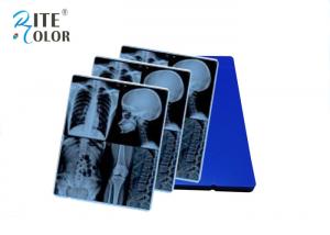 Wholesale Blue Laser X Ray Film Digital X Ray Film For CT MR Equipment Image Output from china suppliers