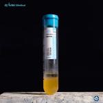 15ml PRP Tubes Relieve Pain ACD-A PRP Gel Separator Tubes