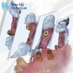 Scan Body All In One Dental Healing Capsule Blue Sky Implant System