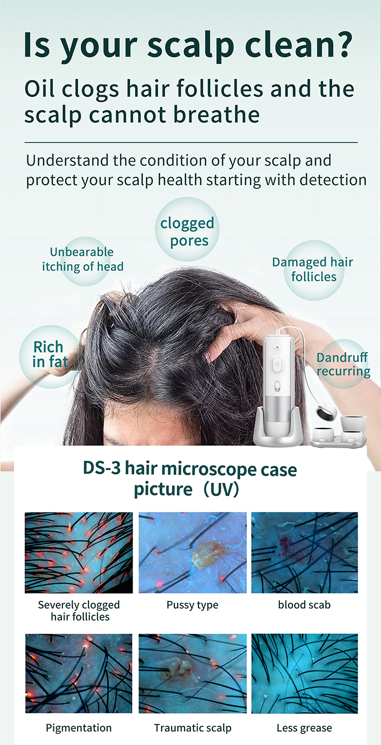 Head Target Area Scalp Analysis Machine Portable Easy Operation With 4 Lens