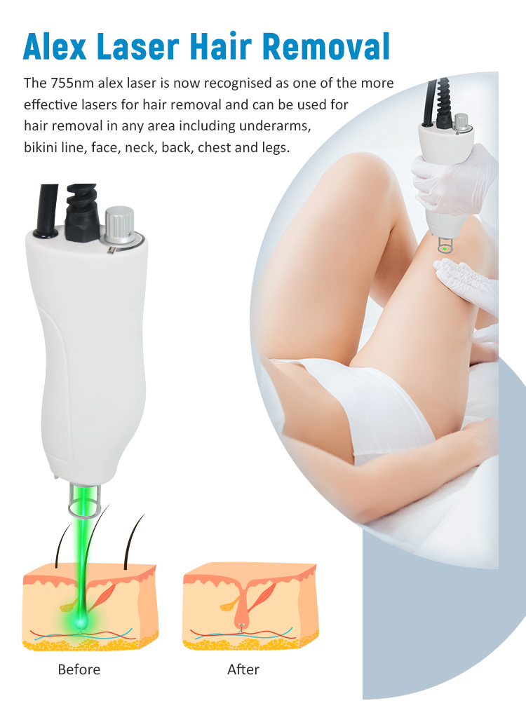 100J/Cm2 Fiber Laser Alexandrite Laser Machine For Blood Vessels Removal