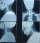KND-K Scratch-resistant Medical Paper Dry Imaging Film For Radiographic