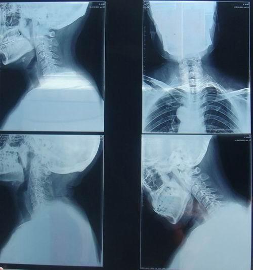 KND-K Scratch-resistant Medical Paper Dry Imaging Film For Radiographic