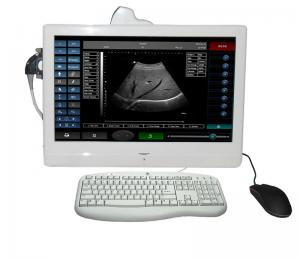 China Touchscreen tablet B mode ultrasound scanner( on promotion) on sale