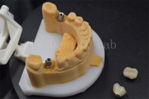 Wholesale Easy To Place Zirconia Teeth Crown Titanium Crowns For Teeth Customised from china suppliers