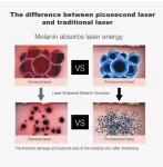 Picolaser Laser Tattoo Removal Machine with 2000W Q Switched Nd Yag
