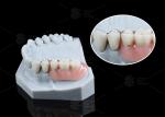 MK1 Attachment Dental Prosthesis Silver Partial Denture Precision Attachments