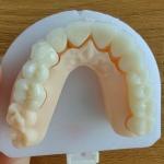 Layered Zirconia Bridge For Fixed Restoration Beautiful Smiles Professional