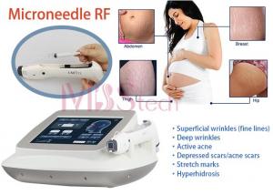 China Stretch Marks Removal Face Lifting Rf Microneedle Machine on sale