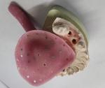 Trushine Premade Custom Trays For Dentures Other Dental Products