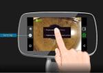 Anterior Segment Imaging 10X 16MP Hand Held Slit Lamp