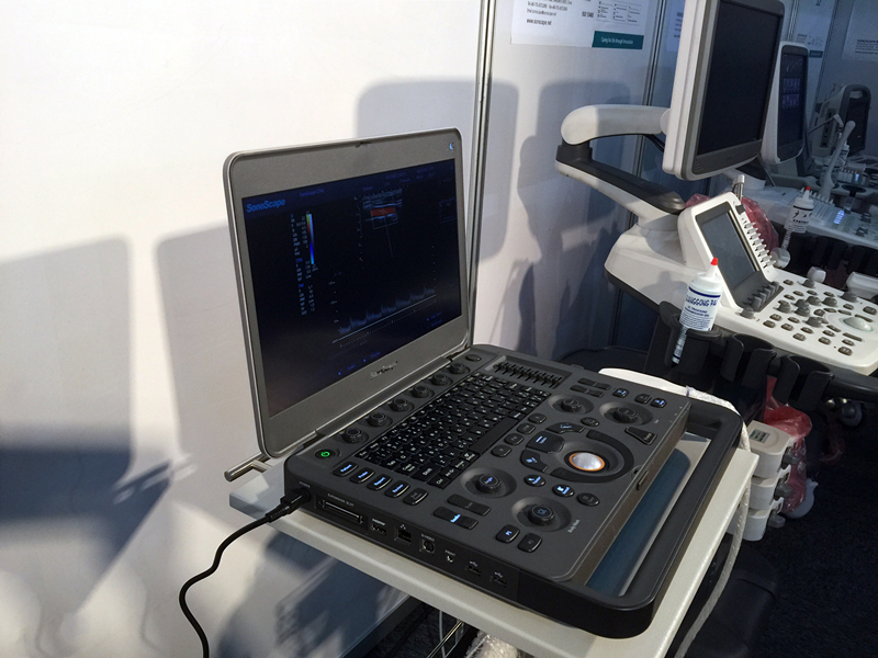 Sonoscape X5 Medical Ultrasound Instruments Machine with Excellent Image Quality