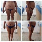 2023 6 In 1 Professional Laser Lipo Body Slimming Tummy Fat Loss Salon Beauty