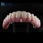Sterilization Steam Sterilization Implant Cases with Universal Compatibility