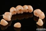 High Translucency Multilayered Full Contour Zirconia Natural looking 1200 HV