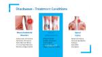The Science Behind Shockwave Devices Transforming Pain Management Machine