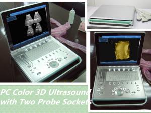 China mobile Digital Ultrasound Scanner Equipment Portable diagnostic machine on sale