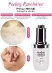 Exfoliating Serum Skin Peeling Solution Acne Remover Skin Care Skin Peeling 30ml