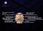 Anti Aging Skin Tightening Hifu High Intensity Focused Ultrasound Machine 10000