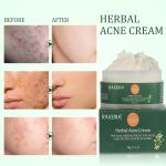 100% Natural Smoothing And Cleaning Herbal Face Cream For Anti Acne