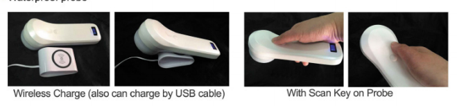 Portable 4D Wireless Bladder Scanner WIFI Ultrasound Probe for Evaluation of Residual Quality After Urination