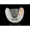 Buy cheap Screw Retained Titanium Custom Abutment Porcelain Fused To Zirconia from wholesalers