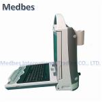 Ultrasonic Diagnostic Automatic High Effective Portable Ultrasound Bone