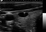 High Resolution Portable Doppler Ultrasound Machine With 6 Inch Full Touch