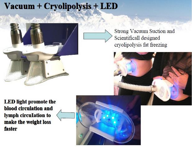 New style 5 handles multifunctional 3 in 1 cryolipolysis slimming machie