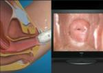 High Definition Women Self-Examination Endoscope AV ( video ) Signal Digital