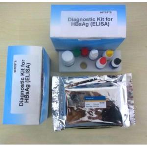 Wholesale Approved FSC Rapid Self Test Kit Medical Diagnostic Device Hbsag from china suppliers