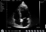Doppler B Mode Ultrasound Scanner 2.2MHz Wireless Ultrasound Machine