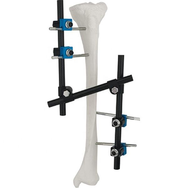 High Quality Orthopedic Surgical Instruments Tibial & Femur External Fixator AO