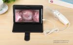 Vaginal Camera Cervix Camera Digital Electronic Video Colposcope for Gyneclogy