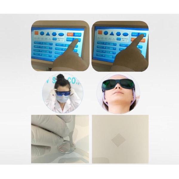 CO2 Fractional Laser Device with Touchscreen Interface for Advanced Skin Therapy Wrinkle Removal and Lifting