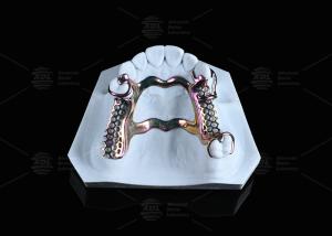 Wholesale Sensitive Skin High Strength Titanium Framework Solution 3D Printed from china suppliers