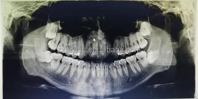 Dental CT Scanning Instruments of ZX Company